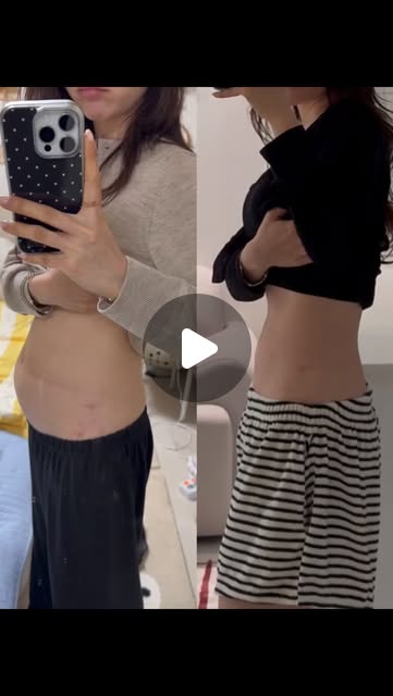 차전자피 & 베르베린